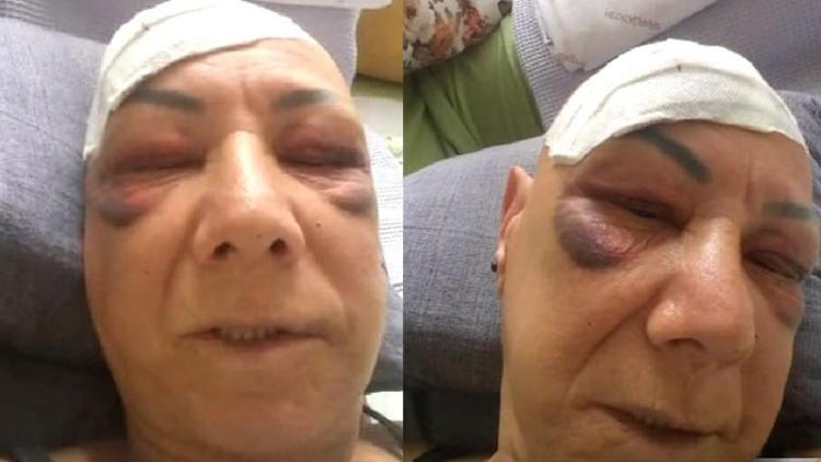 Son dakika... Kavınvalidesini bu hale getirmişti... İşte cezası!