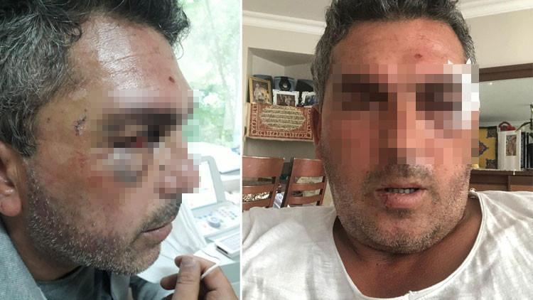 Son dakika haberleri: Gece yarısı kurye dehşeti! Motosikletle başını ezmeye çalıştı...