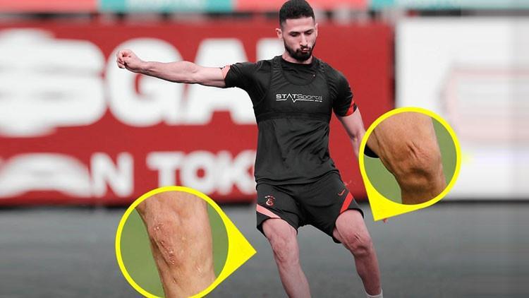 Son Dakika | Galatasaray'da Emre Akbaba'nın dikkat çeken fotoğrafı! Dizleri...
