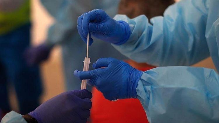 Dünya genelinde Kovid-19'dan iyileşenlerin sayısı 34 milyonu geçti