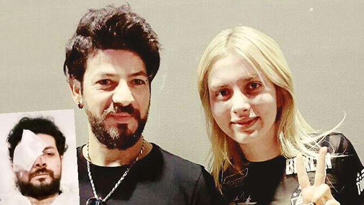 Son dakika: Maganda kâbusu: Genç müzisyen Şahan Dinç gözünü kaybetti...