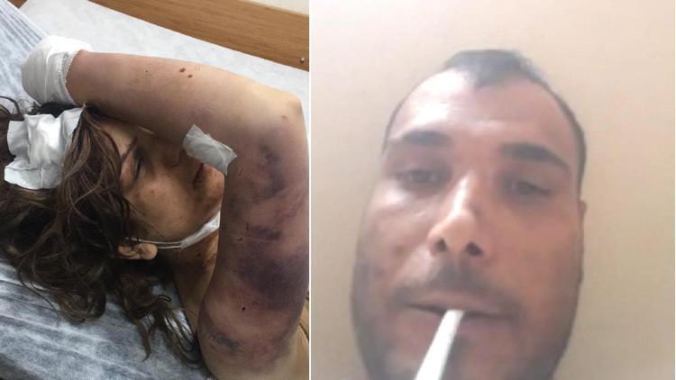 Eşini zincirle bağlayıp, kerpetenle tırnaklarını çekmişti! Kan donduran detaylar