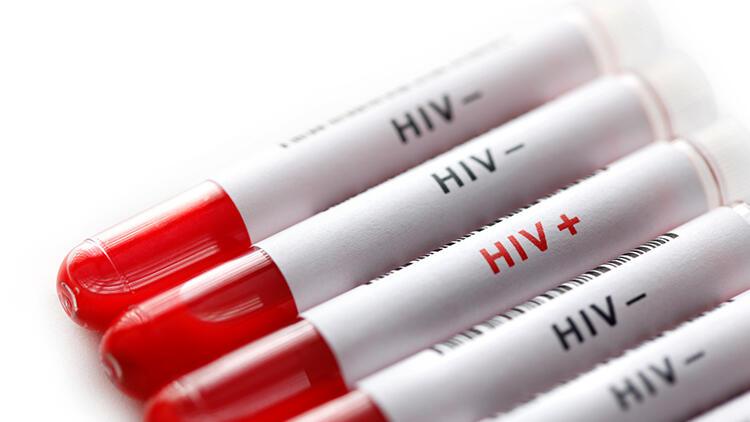 AIDS hayatımızın içinde... Korunmak için neler yapılabilir?