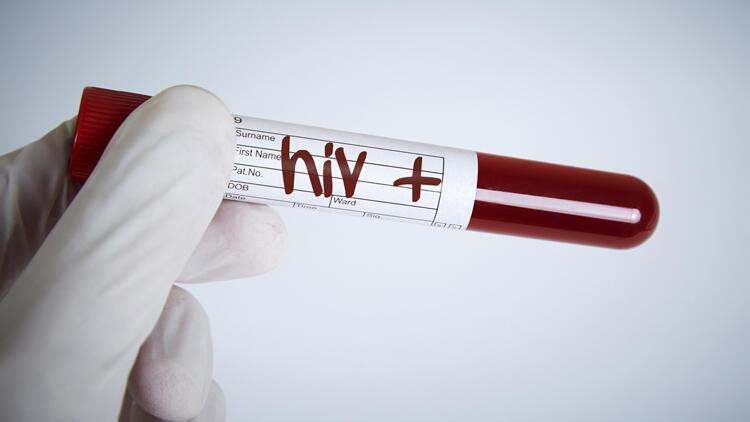 26 bin kişi HIV pozitif