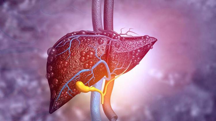 Uzmanından önemli uyarı: A vitamininin fazlası siroza yol açabilir