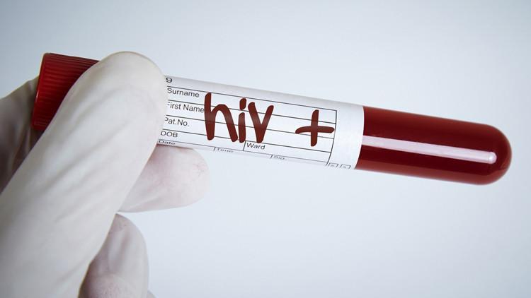 AIDS ve iş hukuku