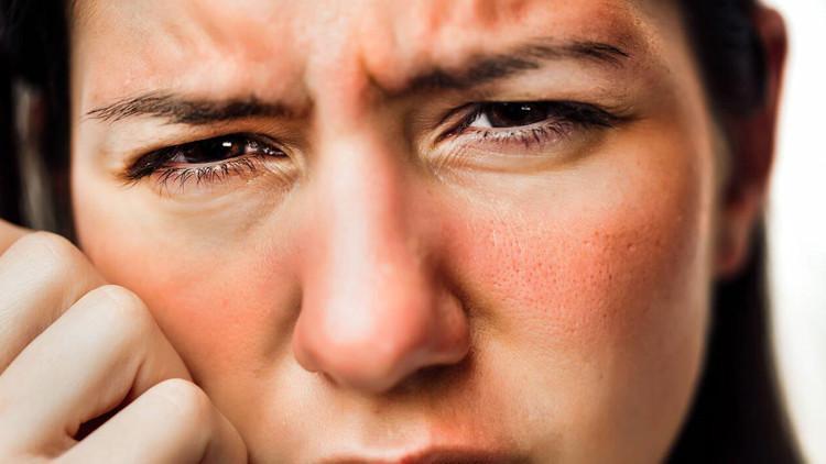 Lupus hastalığı nedir, neden olur? Lupus hastalığı belirtileri, tedavisi…