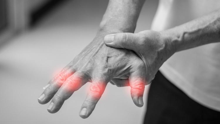 Erkeklerde daha sık görülüyor… Gut hastalığı nedir, tedavisi mümkün mü?