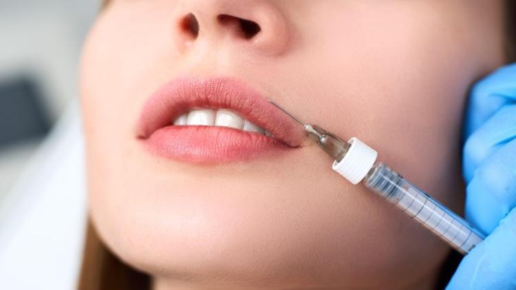 Lip Lifting mi, Dudak Dolgusu mu? Lip Lifting Nedir?
