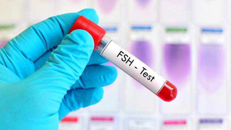 Erkeğe bağlı kısırlık durumunda FSH hormonunun önemi