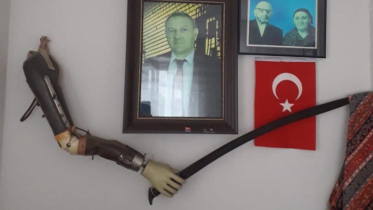 Çanakkale Savaşı'nda kolunu kaybetmişti! Müzede sergilenecek