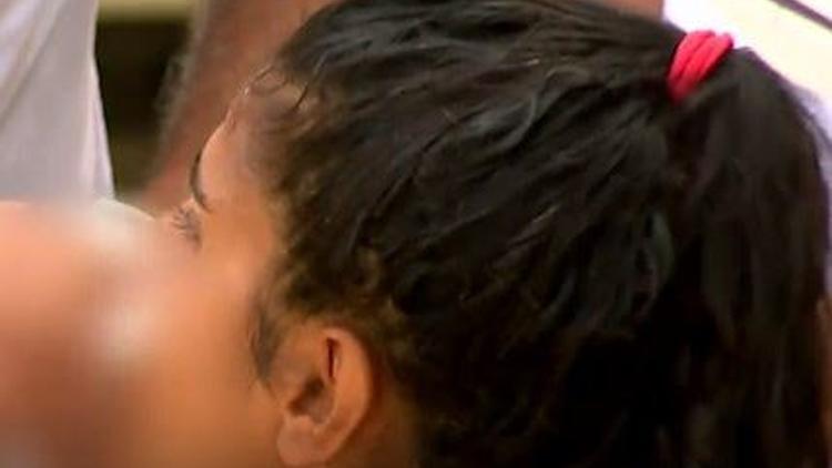 Survivor’da Merve Aydın’a ne oldu? Burnu kırılan Merve Aydın’ın son durumu