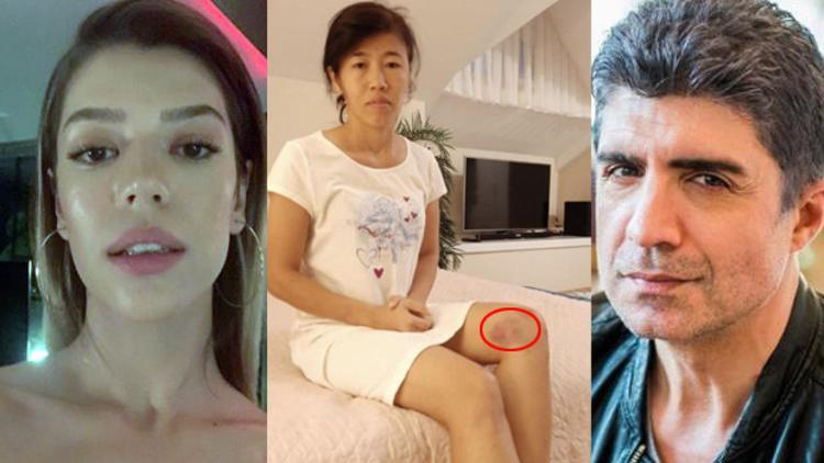 Feyza Aktan oğlu Kuzey'in bakıcısını darp mı etti?