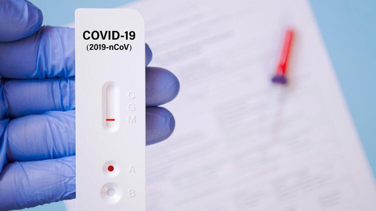 Gözünüzden kaçmış olabilir | Covid-19 testim haftalardır pozitif çıkıyor, virüsü bulaştırır mıyım? Deniz salyası Marmara’yı neden esir aldı? (5-6 Mayıs 2021)