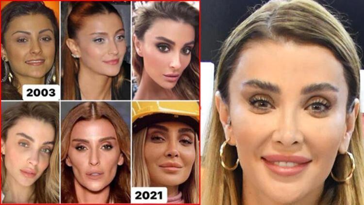 Özge Ulusoy: Burnum dışında yüzümde estetiğim yok!