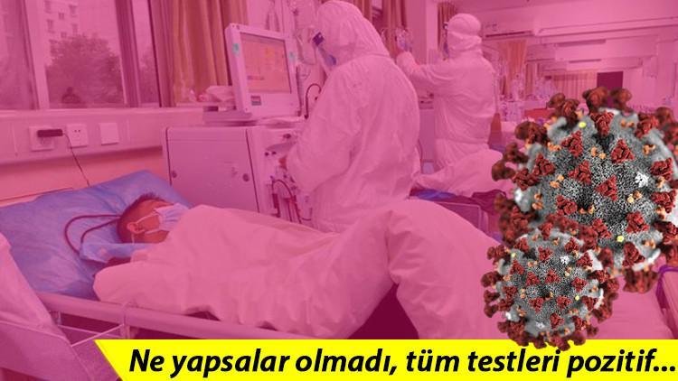 Bilim insanlarını şaşırtan olay! 218 gün Covid-19'u atlatamadı... Tüm testleri pozitif çıktı