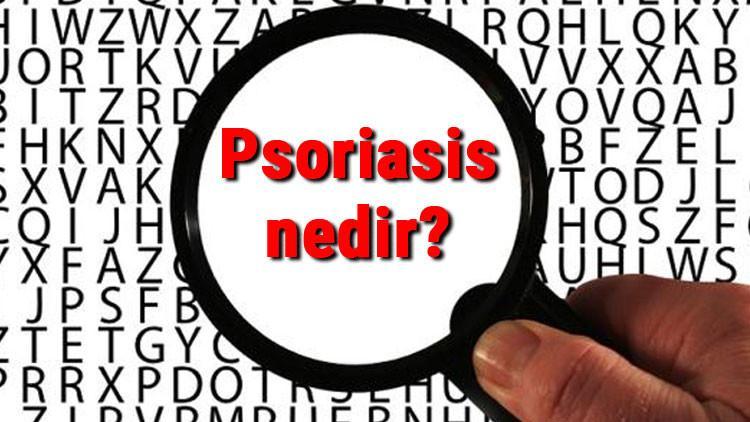 Psoriasis nedir ve nasıl geçer? Psoriasis belirtileri, nedenleri ve tedavisi