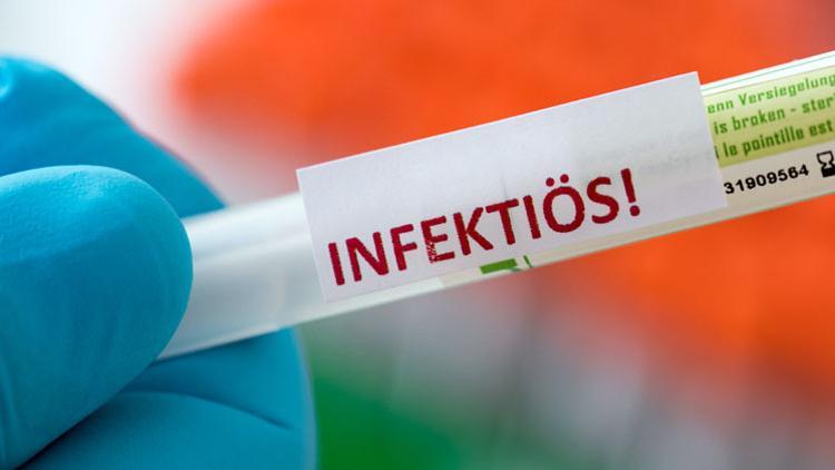 Haftalık insidans değeri 10’u geçti!