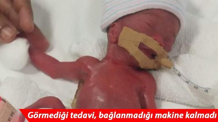 Mucizenin adı: Sadece 212 gram doğan bebek hastaneden taburcu oldu