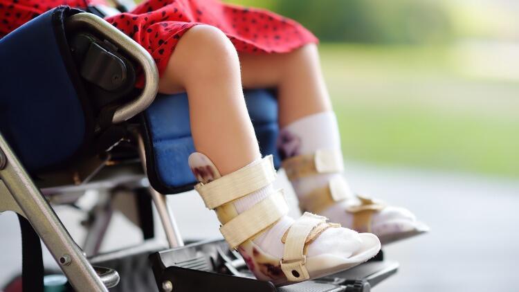 Serebral palsi nedir, belirtileri nelerdir? Serebral palsi hastalığı nedenleri ve tedavisi