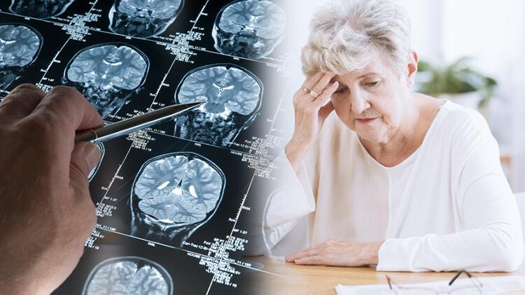 Tek belirtisi unutkanlık değil Bu davranış değişiklikleri Alzheimera işaret ediyor