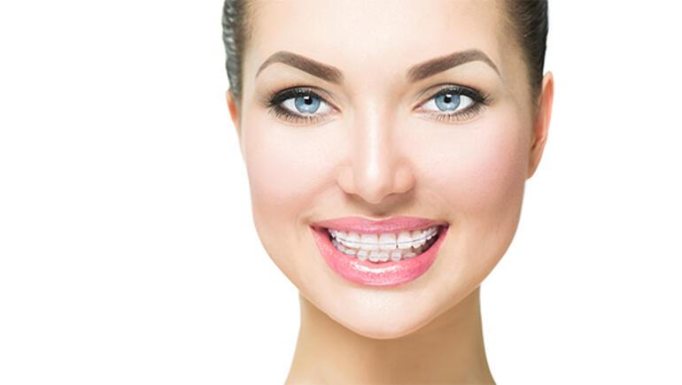 Diş estetiğiyle gülüşünüzü güzelleştirebilirsiniz Sağlık Haberleri