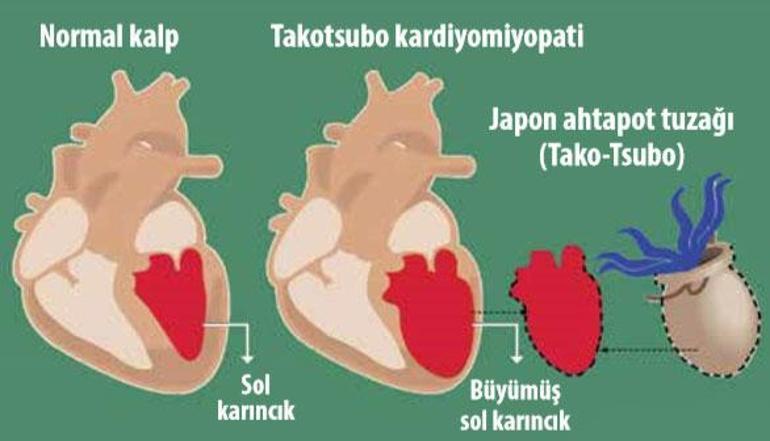 Soguk Havalarda Kalp Sagligini Korumak Icin 6 Oneri Saglik Rehberi