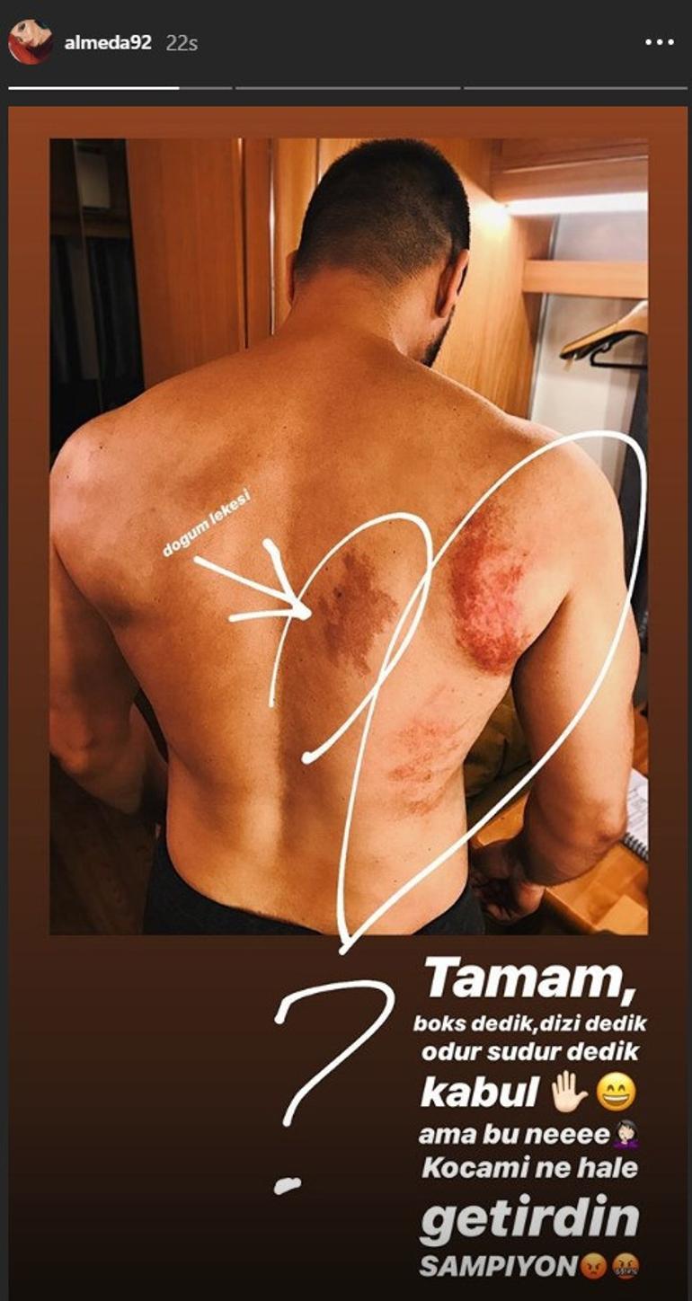 Almeda Abazi: Tamam boks dedik ama bu ne!