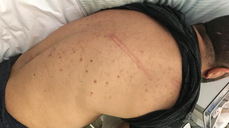 Alman karakolunda 5 polis, bir Türk’e işkence edip sokağa attı