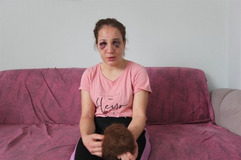 Violence in Aydin, mother of 3 children, her husband converted her