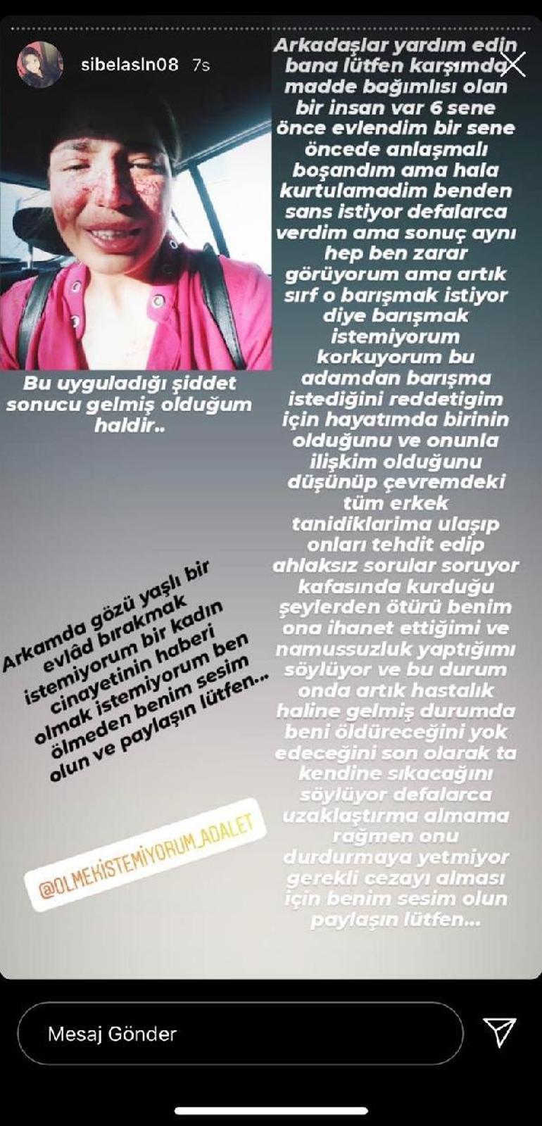 Last minute ... Sibel, who was exposed to the violence of her divorced husband, asked for help on social networks