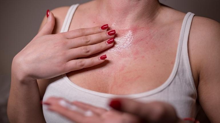 Egzama Hakkında Merak Edilen Her Şey