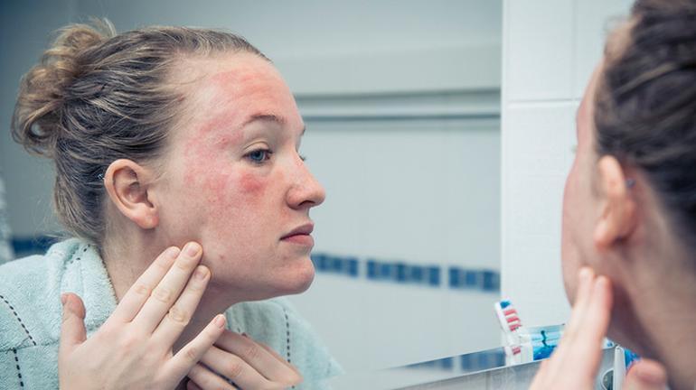 Egzama Hakkında Merak Edilen Her Şey