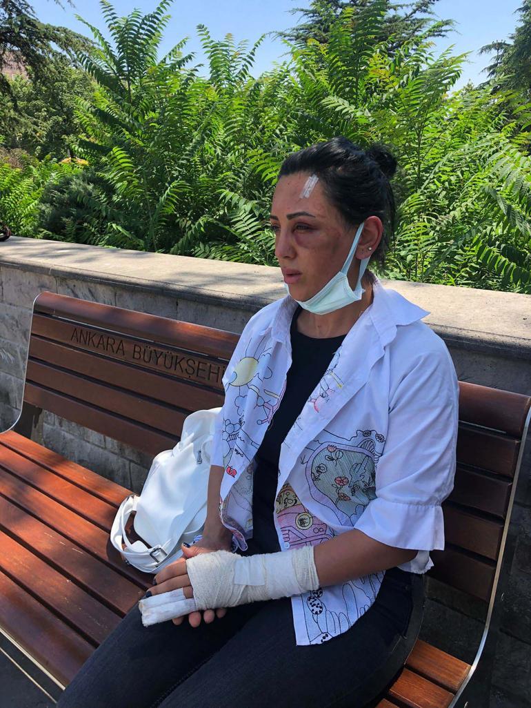 Hayatı alt-üst oldu Yaşadığı 20 dakikalık kâbusu anlattı