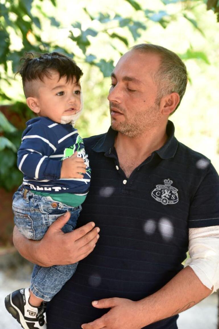 Antalyada pitbull dehşeti Bebeğin yanağını ve kulağını kopardı