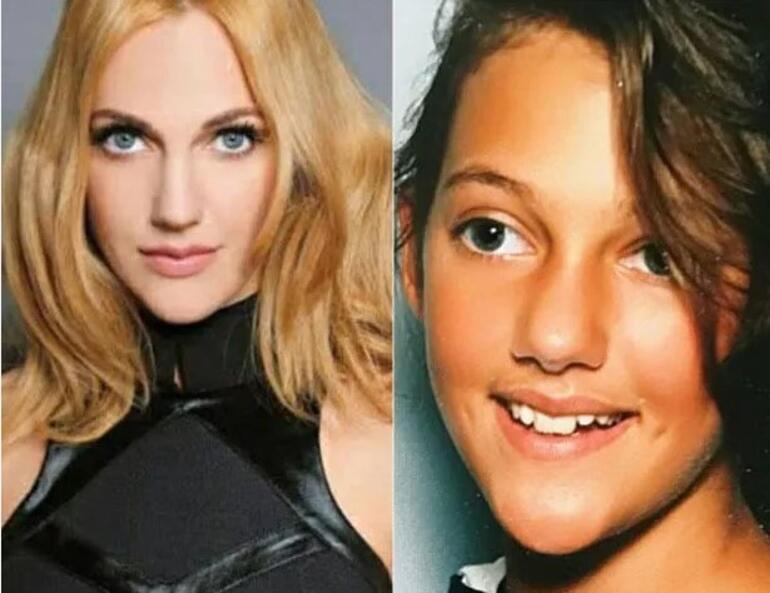 She's a famous singer now: No plastic surgery... Don't lose hope