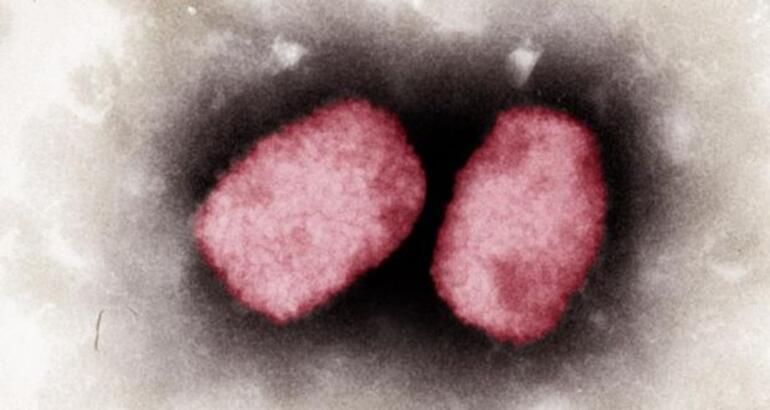 ABDde maymun çiçeği alarmı... CDC aşı kararını açıkladı