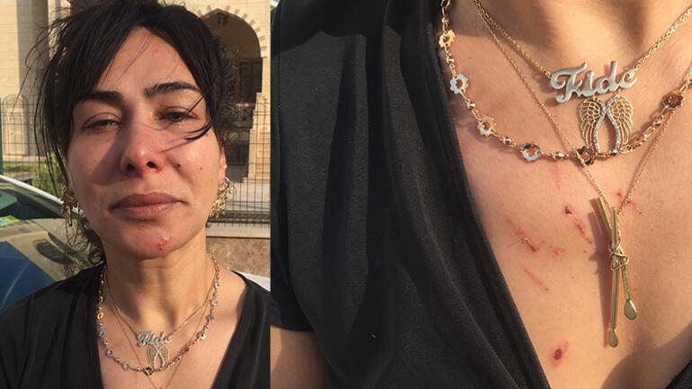 Adanada korkunç iddia Asansörde taciz edip işkence yaptı