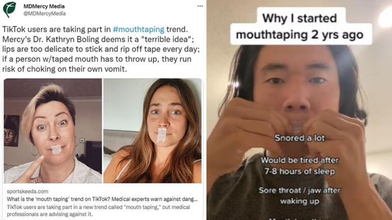 New craze in social media: Mouth taping Warning from experts one after another...