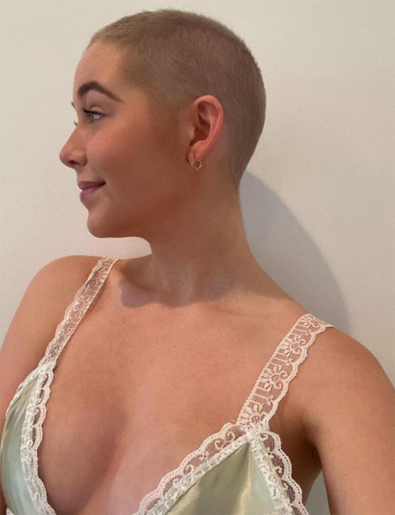 The 19-year-old actress had both breasts removed due to cancer: It's not the end of the world