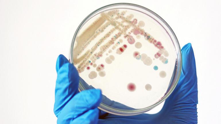Flesh-eating bacteria panic in the USA The number of cases rose to 65...