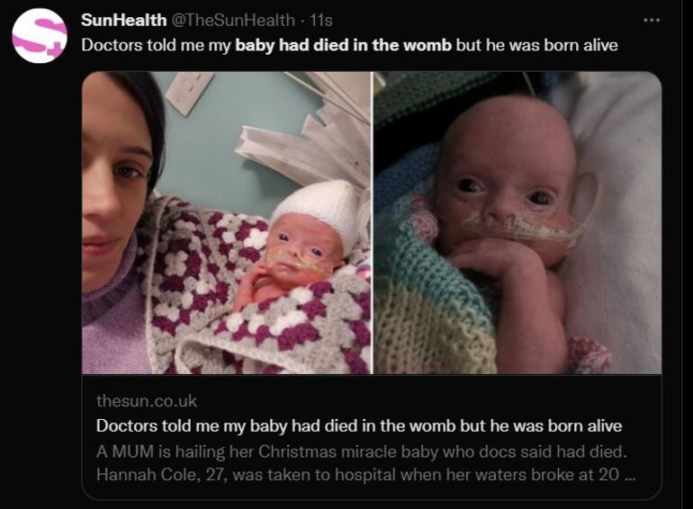 Doktorlar anne karnında öldüğünü söylediler, canlı olarak dünyaya geldi