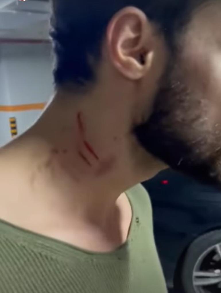Ayşe Aslanpaydan şoke eden iddia: Batuhan Karacakaya tarafından darp edildim