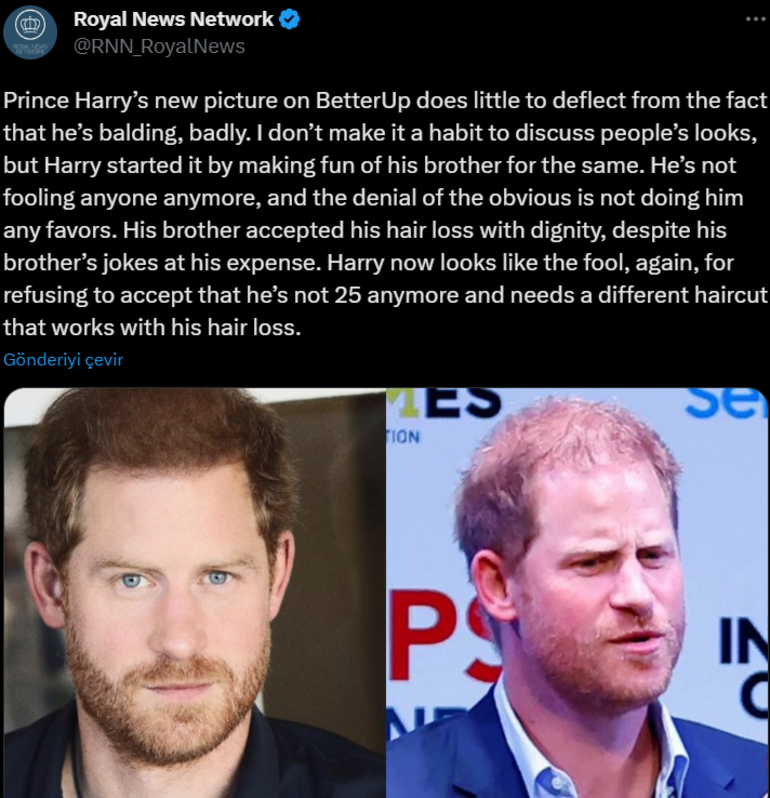 Ağabeyinin dökülen saçlarıyla dalga geçmişti… Prens Harry de alay konusu oldu: Gülme komşuna gelir başına