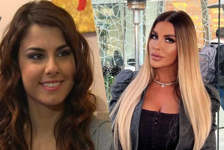 Oyuncu Tuğçe Özbudaktan üzen haber... Kısmi felç geçirdi