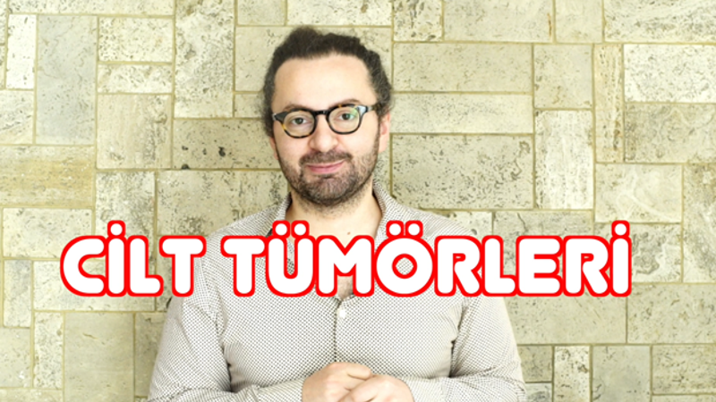 Cilt tümörleri | Doktor Bu Ne?