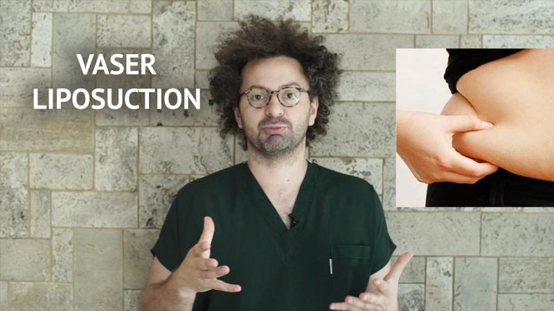 Vaser Liposuction - Şekillendirilmiş Liposuction