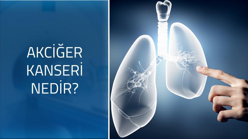 Akciğer kanserinin belirtileri nelerdir?