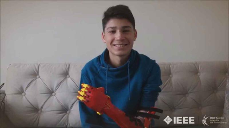 Üniversite öğrencilerinden 14 yaşındaki Mehmet'e 'robot el'