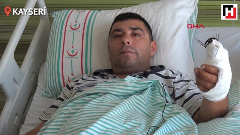 İşçinin kopan 3 parmağı yerine dikildi